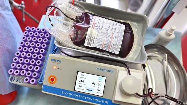 Київщина: громадам слід активно підтримувати донорство — Калашник